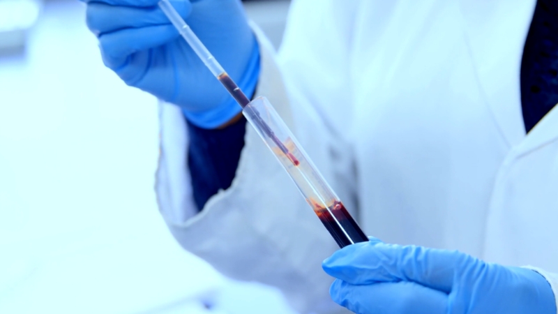 Laboratorijski tehničar pažljivo prebacuje uzorak krvi u epruvetu tokom analize