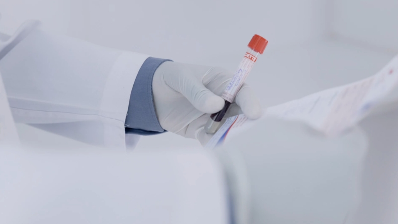 Laboratorijski tehničar drži uzorak krvi i proverava rezultate analize na papiru