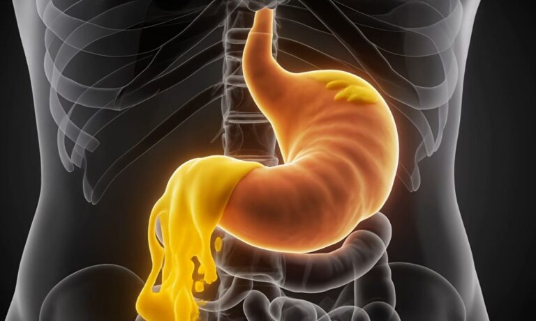 Lek za želudac kod bola i kiseline – kako izabrati pravi