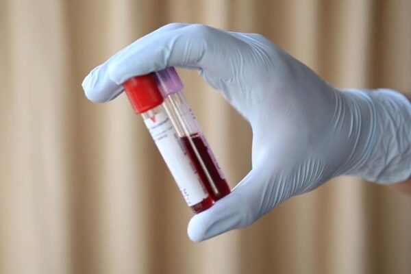 prikazizvađene krvi u bočicama za tesitranje na trombofiliju