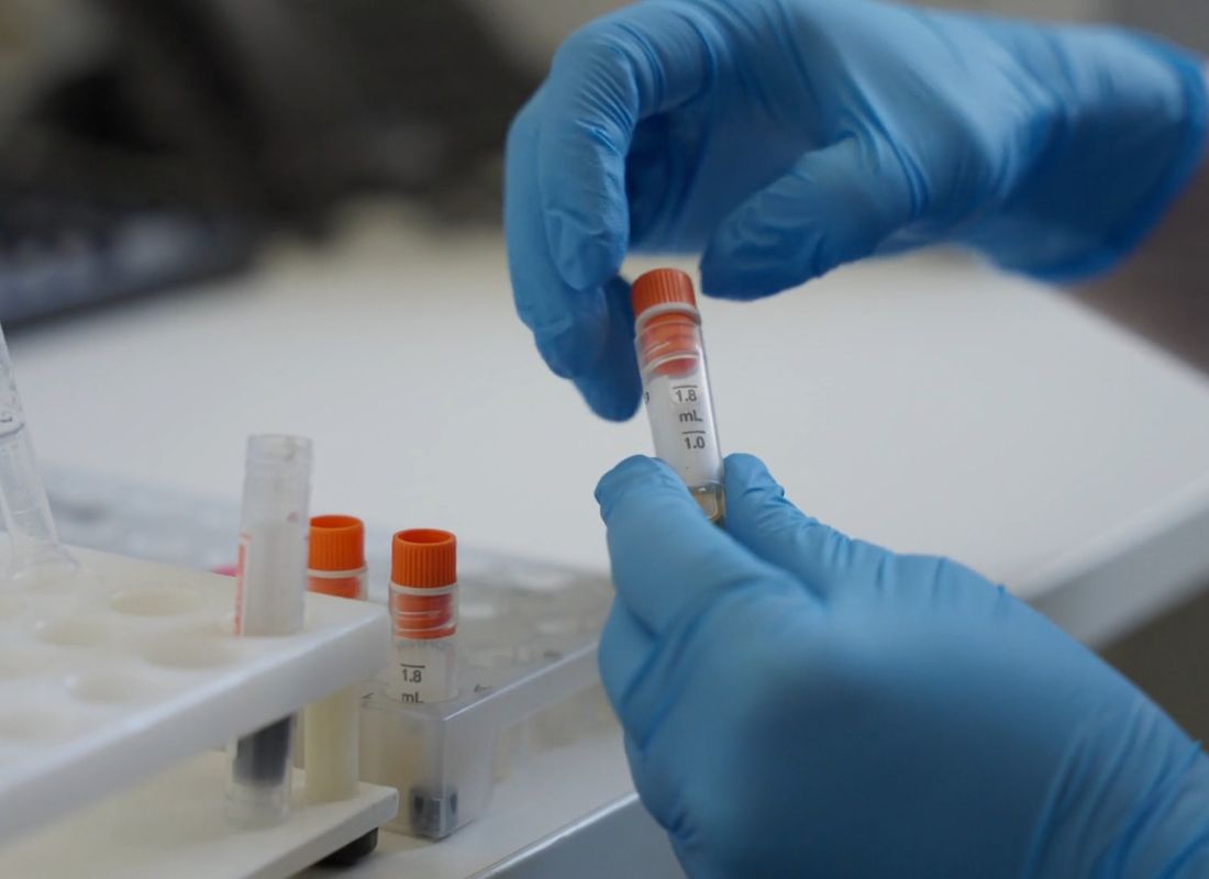 laborant raspoređuje krv za testiranje 