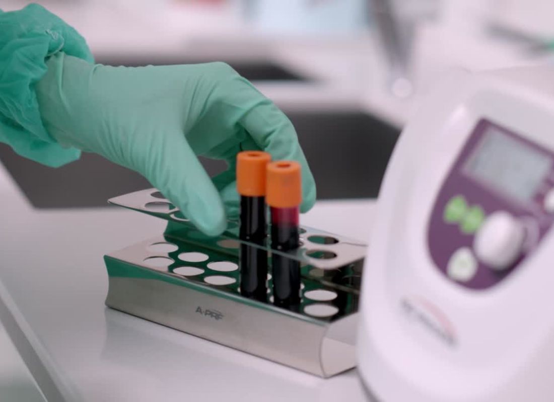 rađenje analize krvi u laboratoriji