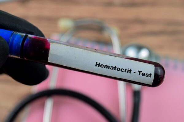 Hematokrit u krvi