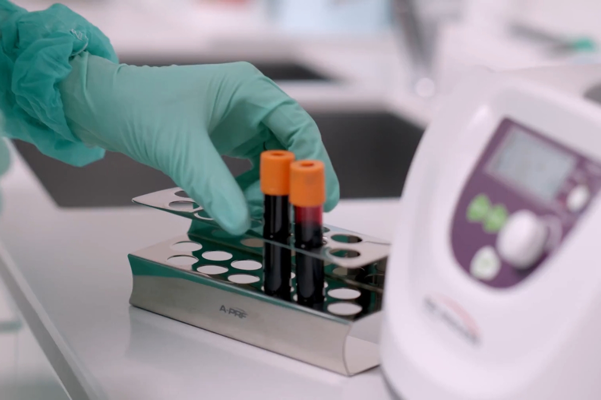 prikaz laboratorije sa epruvetama u kojoj je krv