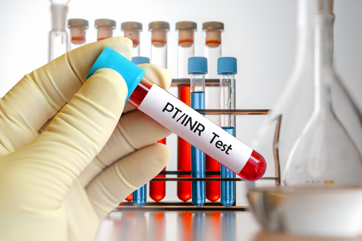 prikaz PT i INR testa 