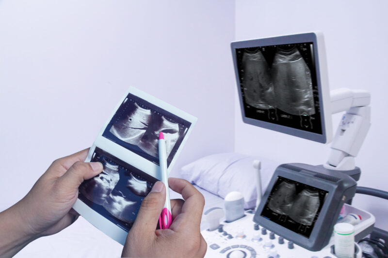 Detaljan ultrazvučni pregled anatomije bebe u sredini trudnoće